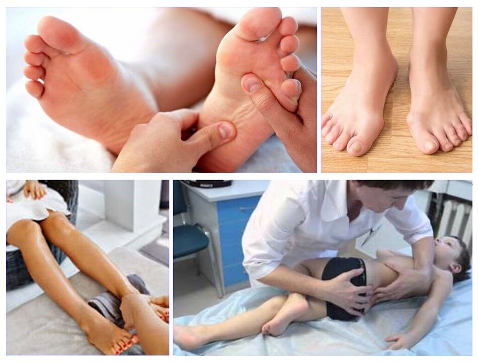 Valgus Verformung an de Kannerbehandlung