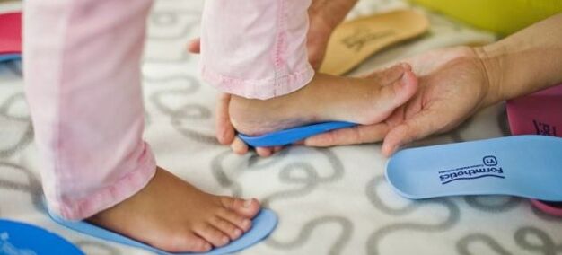 Insoles mat Valgus Deformatioun vum Fouss bei de Kanner