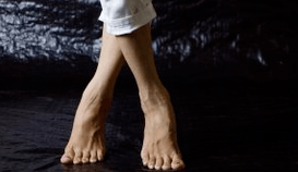 Valgus Verformung